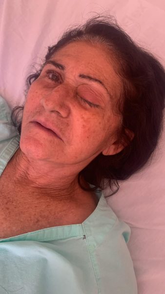 Cabelereira Izabel Maria perdeu a visão do olho esquerdo — Foto: Divulgação